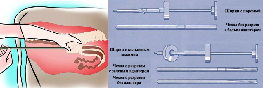 Ректоцервикальное осеменение коров